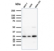 Western blot testing of human samples with Mammaglobin antibody (clone SPM518). Expected molecular weight: 10-21 kDa depending on level of glycosylation.