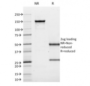 SDS-PAGE analysis of purified, BSA-free CD10 antibody (clone MME/1620) as confirmation of integrity and purity.