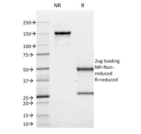 SDS-PAGE analysis of purified, BSA-free CD10 antibody (clone MME/1620) as confirmation of integrity and purity.