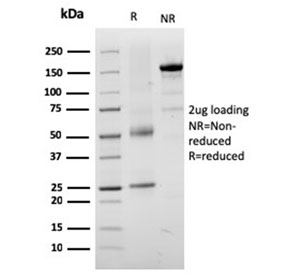 SDS-PAGE analysis of purified, BSA-free TRP1 antibody (clone TYRP1/3282) as confirmation of integrity and purity.