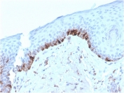 IHC staining of FFPE human skin with TRP1 antibody (clone TYRP1/3282). HIER: boil tissue sections in pH 9 10mM Tris with 1mM EDTA for 20 min and allow to cool before testing.