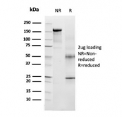 SDS-PAGE analysis of purified, BSA-free TRP1 antibody (clone TYRP1/3283) as confirmation of integrity and purity.