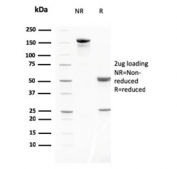 SDS-PAGE analysis of purified, BSA-free MMP3 antibody (clone MMP3/2806) as confirmation of integrity and purity.