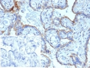 IHC staining of FFPE human placenta with MMP3 antibody. HIER: boil tissue sections in pH 9 10mM Tris with 1mM EDTA for 20 min and allow to cool before testing. Negative control inset: PBS used instead of primary antibody to control for secondary Ab binding.