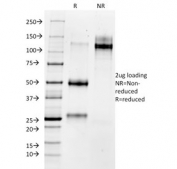 SDS-PAGE analysis of purified, BSA-free MMP3 antibody as confirmation of integrity and purity.