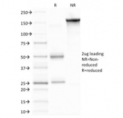 SDS-PAGE analysis of purified, BSA-free Matrix metalloproteinase 9 antibody (clone 2C3) as confirmation of integrity and purity.