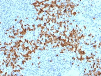 IHC staining of FFPE human spleen with Matrix metalloproteinase 9 antibody (clone 2C3). HIER: boil tissue sections in pH 9 10mM Tris with 1mM EDTA for 20 min and allow to cool before testing.~