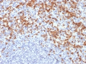 IHC staining of FFPE human spleen with MMP9 antibody (clone MMP9/2477). HIER: boil tissue sections in pH 9 10mM Tris with 1mM EDTA for 20 min and allow to cool before testing.