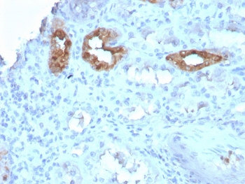 IHC staining of FFPE human kidney with CALB1 antibody. HIER: boil tissue sections in pH 9 10mM Tris with 1mM EDTA for 20 min and allow to cool before testing.