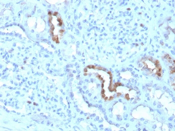 IHC staining of FFPE human kidney with CALB1 antibody. HIER: boil tissue sections in pH 9 10mM Tris with 1mM EDTA for 20 min and allow to cool before testing.
