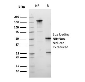 SDS-PAGE analysis of purified, BSA-free CALB1 antibody as confirmation of integrity and purity.