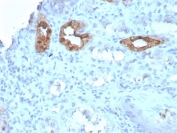 IHC staining of FFPE human kidney with CALB1 antibody (clone CALB1/3333). HIER: boil tissue sections in pH 9 10mM Tris with 1mM EDTA for 20 min and allow to cool before testing.