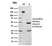 SDS-PAGE analysis of purified, BSA-free MTAP antibody as confirmation of integrity and purity.