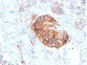 IHC staining of FFPE human kidney with recombinant MTAP antibody. HIER: boil tissue sections in pH 9 10mM Tris with 1mM EDTA for 20 min and allow to cool before testing.