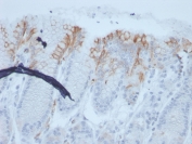 IHC staining of FFPE human stomach with recombinant MUC2 antibody (clone rMLP/842). HIER: boil tissue sections in pH 9 10mM Tris with 1mM EDTA for 20 min and allow to cool before testing.