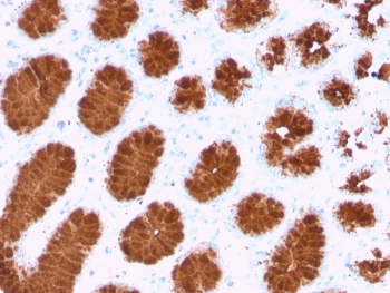 IHC staining of FFPE human colon with recombinant MUC5AC antibody (clone rMUC5AC/3779). HIER: boil tissue sections in pH 9 10mM Tris with 1mM EDTA for 20 min and allow to cool before testing.~