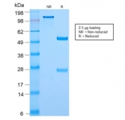 SDS-PAGE analysis of purified, BSA-free recombinant c-Myc antibody (clone MYC2895R) as confirmation of integrity and purity.