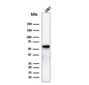 Western blot testing of human U-87 cell lysate with recombinant NGF Receptor antibody (clone rNGFR/1965). Predicted molecular weight: 45-75 kDa depending on glycosylation level.