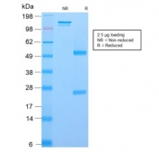 SDS-PAGE analysis of purified, BSA-free recombinant NGF Receptor antibody (clone rNGFR/1965) as confirmation of integrity and purity.