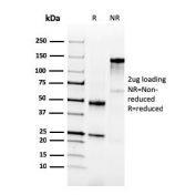 SDS-PAGE analysis of purified, BSA-free NKX3.1 antibody (clone NKX3.1/3350) as confirmation of integrity and purity.