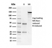 SDS-PAGE analysis of purified, BSA-free NME1 antibody as confirmation of integrity and purity.
