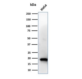 Western blot testing of human HeLa cell lysate with NME1 antibody. Predicted molecular weight ~17 kDa.~