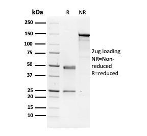 SDS-PAGE analysis of purified, BSA-free NME1 antibody as confirmation of integrity and purity.