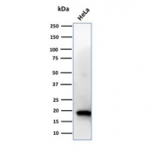 Western blot testing of human HeLa cell lysate with NME1 antibody. Predicted molecular weight ~17 kDa.