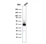 Western blot testing of human K562 cell lysate with recombinant Nucleophosmin antibody. Predicted molecular weight ~38 kDa.