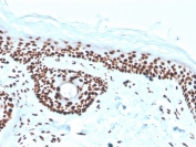 IHC staining of FFPE human skin with recombinant Nucleophosmin antibody (clone rNPM1/1901). HIER: boil tissue sections in pH 9 10mM Tris with 1mM EDTA for 20 min and allow to cool before testing.