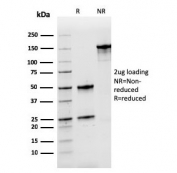 SDS-PAGE analysis of purified, BSA-free recombinant Nucleophosmin antibody (clone rNPM1/1901) as confirmation of integrity and purity.