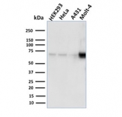 Western blot testing of human samples with NRF1 antibody (clone NRF1/2609). Expected molecular weight: isoforms from 45-67 kDa.