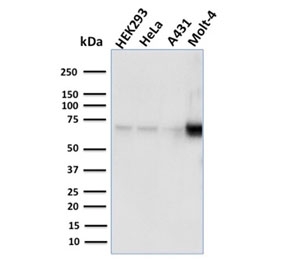 Western blot testing of human samples with NRF1 antibody. Expected molecular weight: isoforms from 45-67 kDa.