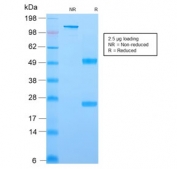 SDS-PAGE analysis of purified, BSA-free recombinant YB-1 antibody (clone rYBX1/2430) as confirmation of integrity and purity.