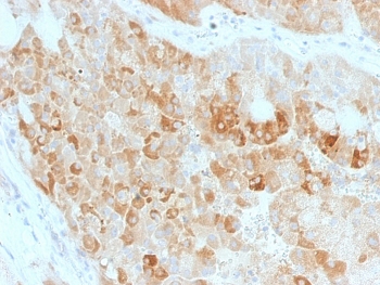 IHC staining of FFPE human kidney with ROR2 antibody. HIER: boil tissue sections in pH 9 10mM Tris with 1mM EDTA for 20 min and allow to cool before testing.~