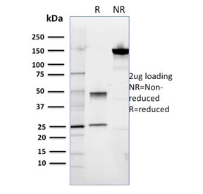 SDS-PAGE analysis of purified, BSA-free ROR2 antibody as confirmation of integ