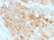 IHC staining of FFPE human kidney with ROR2 antibody (clone ROR2/1911). HIER: boil tissue sections in pH 9 10mM Tris with 1mM EDTA for 20 min and allow to cool before testing.