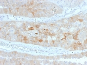IHC staining of FFPE human kidney with ROR2 antibody (clone ROR2/1912). HIER: boil tissue sections in pH 9 10mM Tris with 1mM EDTA for 20 min and allow to cool before testing.