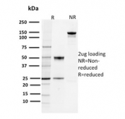 SDS-PAGE analysis of purified, BSA-free PD-L1 antibody (clone PDL1/2744) as confirmation of integrity and purity.