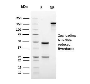 SDS-PAGE analysis of purified, BSA-free recombinant ODC1 antibody (clone rODC1/485) as confirmation of integrity and purity.