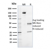 SDS-PAGE analysis of purified, BSA-free OGG1 antibody (clone CPTC-OGG1-1) as confirmation of integrity and purity.