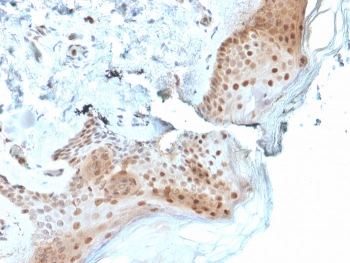 IHC staining of FFPE human skin with OGG1 antibody. HIER: boil tissue sections in pH 9 10mM Tris with 1mM EDTA for 20 min and allow to cool before testing.~