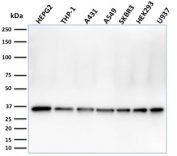 Western blot testing of human samples with PCNA antibody (clone PC5). Expected molecular weight: 29-36 kDa.