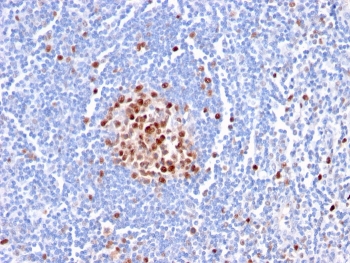 IHC staining of FFPE human tonsil with PCNA antibody (clone PC5). HIER: boil tissue sections in pH 9 10mM Tris with 1mM EDTA for 20 min and allow to cool before testing.
