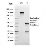 SDS-PAGE analysis of purified, BSA-free recombinant CD31 antibody (clone rC31.3) as confirmation of integrity and purity.