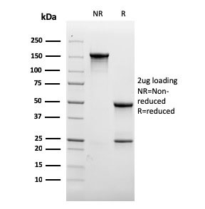 SDS-PAGE analysis of purified, BSA-free recombinant CD31 antibody