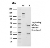 SDS-PAGE analysis of purified, BSA-free recombinant IgM antibody (clone rIGHM/1623) as confirmation of integrity and purity.
