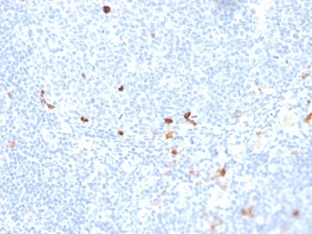 IHC staining of FFPE human tonsil with recombinant IgM antibody (clone rIGHM/1623). HIER: boil tissue sections in pH 9 10mM Tris with 1mM EDTA for 10-20 min and allow to cool before testing.~