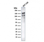 Western blot testing of human HCT116 lysate with MSH6 antibody (clone MSH6/3091). Expected molecular weight: 120-160 kDa depending on phosphorylation level.