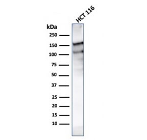 Western blot testing of human HCT116 lysate with MSH6 antibody (clone MSH6/3091). Predicted molecular weight ~160 kDa.